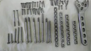 Рязанские хирурги по кусочкам собрали мотоциклиста после ДТП