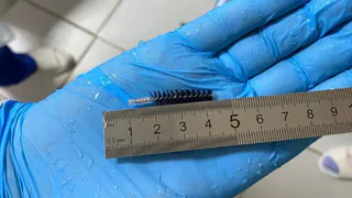 Во Владимире врачи достали из дыхательных путей пациента обломок ершика