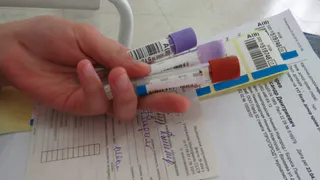 217 человек: в Рязанской области резко увеличилось число условных и подтвержденных диагнозов COVID-19