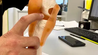 Суставы “щёлкают”, но боли и отёка нет: это нормально? Отвечает ортопед