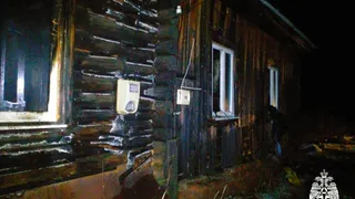 В Сараевском районе в результате пожара пострадал 18-летний парень