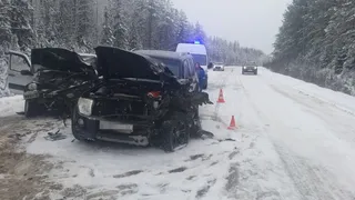 В результате жесткого ДТП маленький ребенок получил серьезные травмы