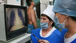 В Нижнекамске наблюдается рост заболеваемости туберкулезом среди детей