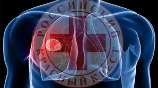 Брянское отделение Красного Креста напоминает о том, как избежать заражения туберкулёзом