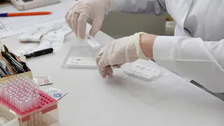 В Нижнекамске можно будет пройти бесплатное экспресс-тестирование на ВИЧ