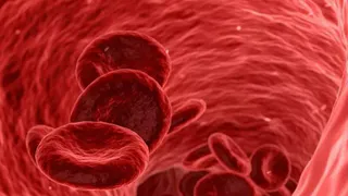 Названы три напитка, которые защитят от тромбоза