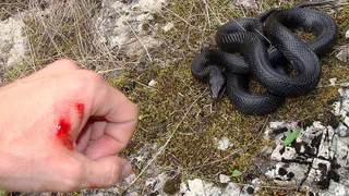 Врачи спасли нижнекамца после укуса змеи