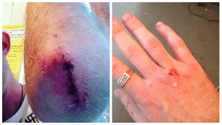 Не дал закурить: в Новомичуринске на мужчину напали хулиганы