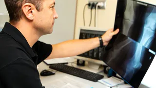 Опасно ли делать протезирование колена после операции на венах? Отвечает эксперт