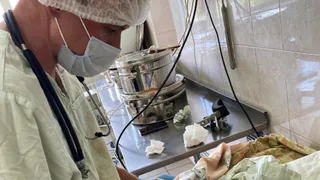 Рязанские врачи спасли беременную женщину с острым холециститом