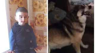 Во Владимирской области собака укусила мальчика в промежность