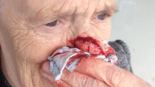 В Приокском на женщину набросилась собака  - Pro Город связался с родственниками пострадавшей