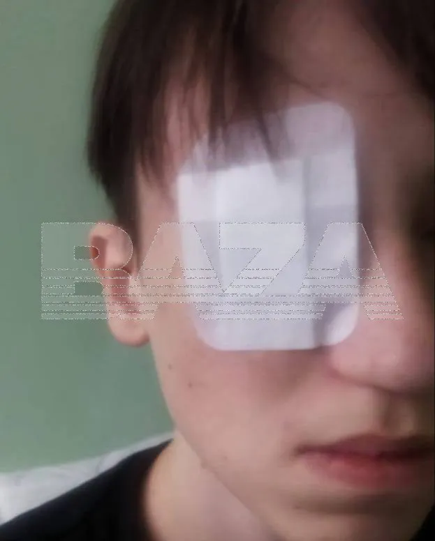 Подросток в Башкирии лишился глаза после выстрела из пневматического пистолета