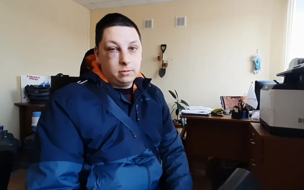 "Кричал, что я на него напал": рязанец, которого избили из-за критики качества капремонта, рассказал свою историю