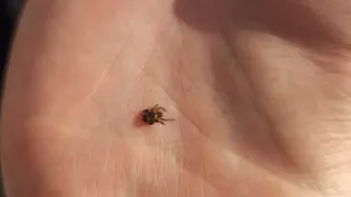 За неделю с укусами клещей в Рязанской области обратился 31 человек