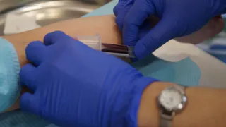 Новый симптом? Некоторые больные коронавирусом отмечают жжение на коже