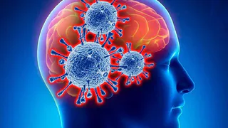 Короновирус COVID-19 отбирает у головного мозга до 20 лет жизни