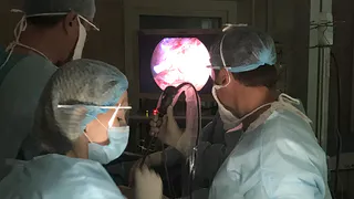 Врачи ОКБ удалили больному онкологией часть легкого через маленькие разрезы