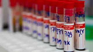 Суперсолдаты: названа уникальная группа крови с «генами войны»