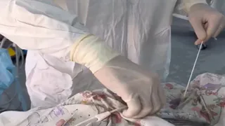 Во Владимирской ОДКБ детям с онкологией упростили прохождение химиотерапии