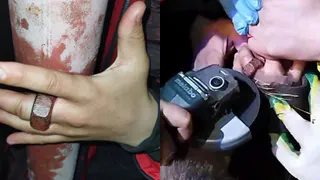 Во Владимире спасателям пришлось вызволять 11-летнего мальчика, засунувшего палец в приваренную к столбу гайку