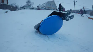 Рязанские травматологи бьют тревогу: чем опасны ватрушки?