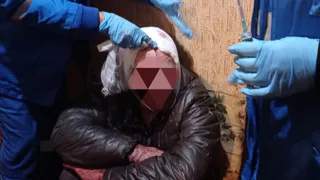 У жителя Рязанской  области после падения с лестницы открылось кровотечение