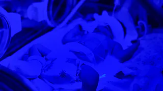 В Рязани врачи перинатального центра спасли малыша с конфликтом по резус-фактору