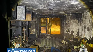 В Сыктывкаре на пожаре пострадали мужчина и бабушка