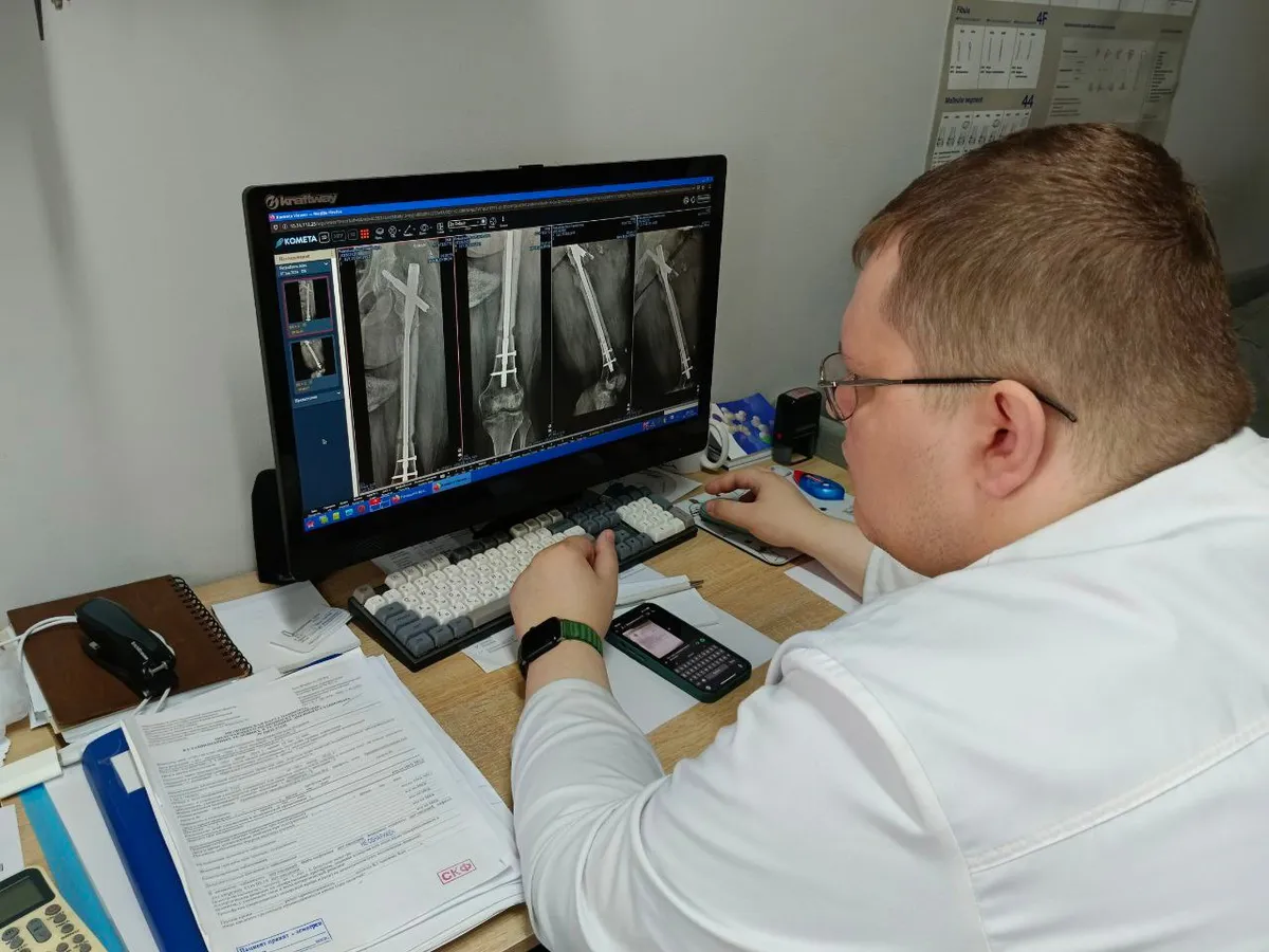 Травматологи ЧОКБ вернули возможность передвигаться пациентке, которая потеряла ногу в ДТП