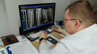 Травматологи ЧОКБ вернули возможность передвигаться пациентке, которая потеряла ногу в ДТП