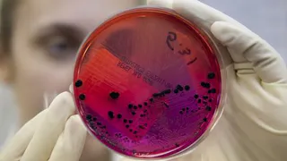 С подозрением на сибирскую язву в Елабуге госпитализировали мужчину