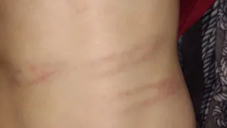 В Сураже водитель такси избил студента битой