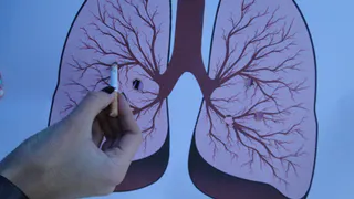 Рязанка рассказала, как отучила сына-подростка от сигарет, показав ему легкие курильщика