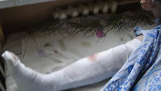 Многофункциональный центр заплатит рязанке 90 тысяч рублей за сломанную ногу