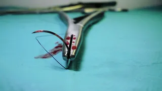 На счету каждая минута: флеболог раскрыл симптомы, предшествующие отрыву тромба