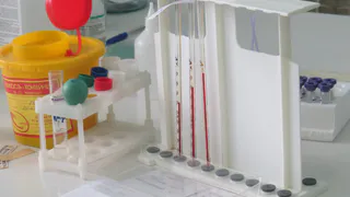 Рязанцу пострадавшему в ДТП срочно требуются доноры крови