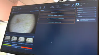 В Рязанском онкодиспансере с помощью системы искусственного интеллекта обследовали уже 50 пациентов