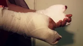 Взрыв во дворе школы в Ростове-на-Дону - сторож лишился кисти рук, приняв "огонь" на себя