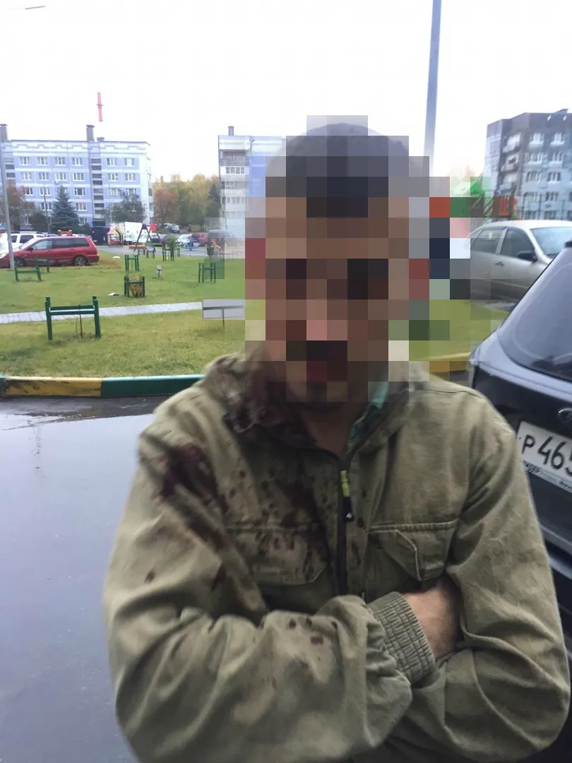 Жена избитого молотком рязанца, опасается, что обвиняемый избежит сурового наказания