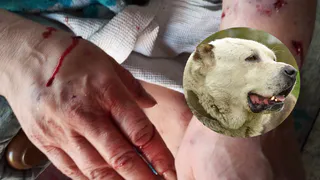 "Собака набросилась на нее и пыталась впиться в шею" - женщина, которая стала свидетелем нападения алабая в Полянах