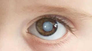 Малышку из Владимира отправили на операцию в Москву из-за травмы цветочным шипом