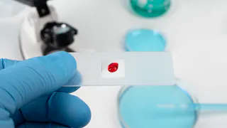 В Чувашии выделят 1,2 млн рублей на закупку тестов на ВИЧ и гепатит