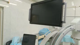 Одна из ЦРБ Коми приобрела высококлассную рентгеновскую систему