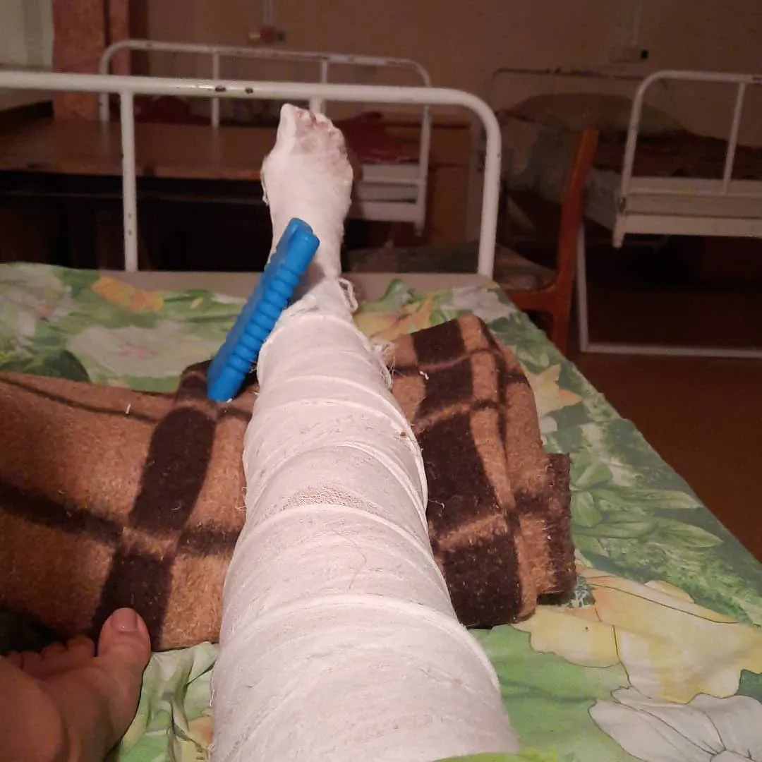 В Рязани беременная девушка выходила из маршрутки и сломала ногу