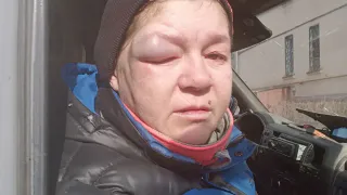 Водитель "Тойоты" подбил глаз женщине после дорожного конфликта в Магнитогорске