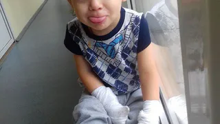 Малыш, получивший страшную травму электрическим током, проходит дорогостоящую реабилитацию