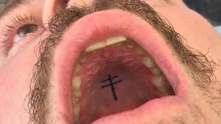 В 2020 году среди представителей молодежи пошла новая мода на татуировки во рту