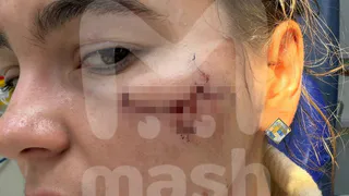 Победительницу конкурсов красоты избили в клубе отеля Korston Royal в Казани: нападавших задержали