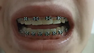 В РязГМУ появится новая образовательная программа по стоматологии 